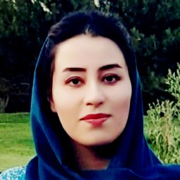 Sepideh Tahsini Tekantapeh (M.D.)